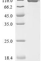 Human Epidermal growth factor receptor (EGFR), partial, Biotinylated Recombinant Protein - BioCrest Sci