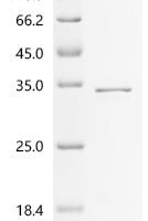 Human Serine/arginine-rich splicing factor 9 (SRSF9) Recombinant Protein, C-His - BioCrest Sci