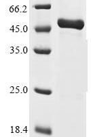 Human Chorionic somatomammotropin hormone 2 (CSH2) Recombinant Protein - BioCrest Sci