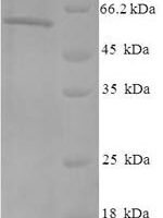 Human Casein kinase II subunit alpha (CSNK2A1) Recombinant Protein, N-His-SUMO - BioCrest Sci