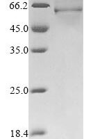 Human Protein DEK (DEK) Recombinant Protein - BioCrest Sci