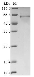 Human Protein DEK (DEK) Recombinant Protein, Homo sapiens (Human), Baculovirus, N-terminal 10xHis-tagged and C-terminal Myc-tagged, 46.4 kDa, purity >≥ 85% as determined by SDS-PAGE.