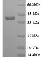 Saccharomyces cerevisiae Homocysteine S-methyltransferase 1 (MHT1) Recombinant Protein - BioCrest Sci