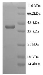 Saccharomyces cerevisiae Homocysteine S-methyltransferase 1 (MHT1) Recombinant Protein, Saccharomyces cerevisiae (strain ATCC 204508 / S288c) (Baker's yeast), E.coli, N-terminal 6xHis-tagged, 40.7 kDa, purity >≥ 90% as determined by SDS-PAGE.