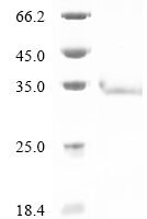 Mouse Reticulon-3 (Rtn3), partial Recombinant Protein - BioCrest Sci