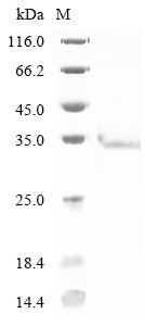 Mouse Reticulon-3 (Rtn3), partial Recombinant Protein, Mus musculus (Mouse), E.coli, N-terminal 6xHis-tagged, 32.5 kDa, purity >≥ 85% as determined by SDS-PAGE.