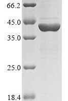 Rauvolfia serpentina Strictosidine synthase (STR1) Recombinant Protein - BioCrest Sci