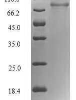 Human RNA-binding motif protein, Y chromosome, family 1 member F/J (RBMY1F) Recombinant Protein - BioCrest Sci