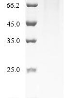 Human Mesothelin-like protein (MSLNL), partial Recombinant Protein - BioCrest Sci