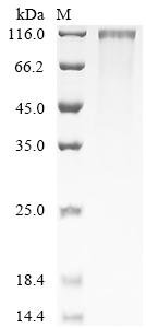 Human Mesothelin-like protein (MSLNL), partial Recombinant Protein, Homo sapiens (Human), Mammalian cell, C-terminal 10xHis-tagged, 68.6 kDa, purity >≥ 95% as determined by SDS-PAGE.