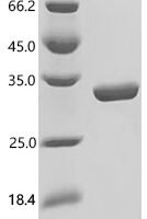 Mouse Desmoplakin (Dsp), partial Recombinant Protein, C-His - BioCrest Sci
