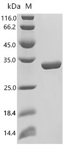 Mouse Desmoplakin (Dsp), partial Recombinant Protein, C-His, Mus musculus (Mouse), E.coli, C-terminal 6xHis-tagged, 31.2 kDa, purity >≥ 85% as determined by SDS-PAGE.