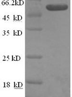 Human Tumor necrosis factor ligand superfamily member 10 (TNFSF10), partial Recombinant Protein, N-GST - BioCrest Sci