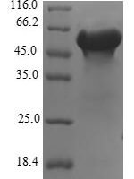Human FK506-binding protein-like (FKBPL) Recombinant Protein - BioCrest Sci