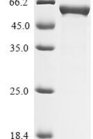 Rat Glial fibrillary acidic protein (Gfap) Recombinant Protein - BioCrest Sci