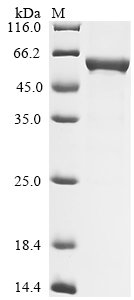 Rat Glial fibrillary acidic protein (Gfap) Recombinant Protein, Rattus norvegicus (Rat), E.coli, N-terminal 6xHis-tagged, 55.9 kDa, purity >≥ 85% as determined by SDS-PAGE.