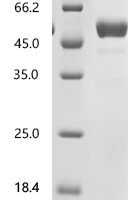 Human Tumor necrosis factor ligand superfamily member 15 (TNFSF15), partial Recombinant Protein - BioCrest Sci