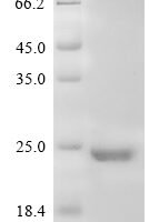 Human Somatotropin (GH1) Recombinant Protein, N-10His - BioCrest Sci