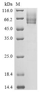 Human betacoronavirus 2c EMC/2012 Spike glycoprotein (S), partial Recombinant Protein, N-His-SUMOstar, Human betacoronavirus 2c EMC/2012, Yeast, N-terminal 6xHis-sumostar-tagged, 40.2 kDa, purity >≥ 85% as determined by SDS-PAGE.