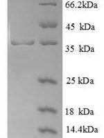 Human Glycophorin (GYPA), partial Recombinant Protein - BioCrest Sci