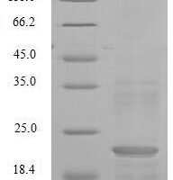 Mouse Normal mucosa of esophagus-specific gene 1 protein (Nmes1) Recombinant Protein, C-Flag-Myc - BioCrest Sci