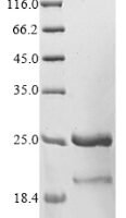 Plasmodium falciparum L-lactate dehydrogenase, partial Recombinant Protein - BioCrest Sci