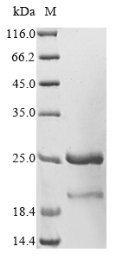 Plasmodium falciparum L-lactate dehydrogenase, partial Recombinant Protein, Plasmodium falciparum, E.coli, N-terminal 10xHis-SUMO-tagged and C-terminal Myc-tagged, 21.0 kDa, purity >≥ 85% as determined by SDS-PAGE.