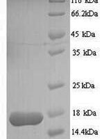 Entamoeba histolytica Multidrug resistance protein 1 (MDR1) Recombinant Protein - BioCrest Sci