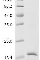 Mouse Sphingosine 1-phosphate receptor 5 (S1pr5), partial Recombinant Protein - BioCrest Sci