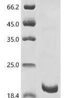 Atrax robustus Delta-hexatoxin-Ar1a Recombinant Protein, N-His-KSI - BioCrest Sci