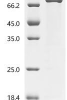 Human Protein-arginine deiminase type-1 (PADI1) Recombinant Protein, C-His - BioCrest Sci