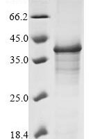 Varicella-zoster virus Envelope glycoprotein H (gH), partial Recombinant Protein, N-10His/C-Myc - BioCrest Sci