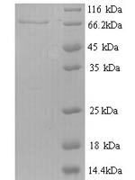 Mouse Receptor-type tyrosine-protein phosphatase N2 (Ptprn2), partial Recombinant Protein - BioCrest Sci