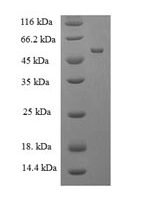 Human Muscleblind-like protein 1 (MBNL1) Recombinant Protein - BioCrest Sci