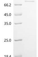 Rat Inhibin beta C chain (Inhbc) Recombinant Protein - BioCrest Sci