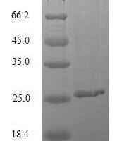 Mycobacterium tuberculosis Immunogenic protein MPT64 (mpt64) Recombinant Protein, N-10His - BioCrest Sci