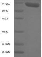 Rabbit Vascular endothelial growth factor A (VEGFA) Recombinant Protein - BioCrest Sci