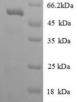 Human Kallikrein-7 (KLK7), partial Recombinant Protein, N-GST - BioCrest Sci