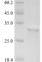 Human Cerebellar degeneration-related antigen 1 (CDR1) Recombinant Protein - BioCrest Sci