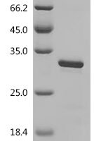 Mouse Indian hedgehog protein (Ihh), partial Recombinant Protein, C-His - BioCrest Sci