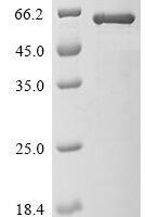 Chandipura virus Glycoprotein G (G), partial Recombinant Protein - BioCrest Sci