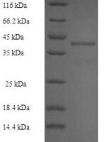 Mouse Ribosyldihydronicotinamide dehydrogenase [quinone] (Nqo2) Recombinant Protein, N-His-SUMO - BioCrest Sci