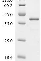 Human Free fatty acid receptor 2 (FFAR2), partial Recombinant Protein - BioCrest Sci