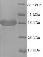Human Signal-regulatory protein delta (SIRPD) Recombinant Protein - BioCrest Sci