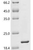Staphylococcus aureus Sortase A (srtA) (P94R,D160N,D165A,K190E,K196T), partial Recombinant Protein - BioCrest Sci