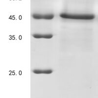Macaca fascicularis Heat-stable enterotoxin receptor (GUCY2C), partial Recombinant Protein - BioCrest Sci