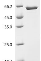 Human Serine/threonine-protein phosphatase 2A 55 kDa regulatory subunit B alpha isoform (PPP2R2A) Recombinant Protein - BioCrest Sci