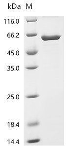 Human Serine/threonine-protein phosphatase 2A 55 kDa regulatory subunit B alpha isoform (PPP2R2A) Recombinant Protein, Homo sapiens (Human), E.coli, N-terminal 6xHis-tagged, 58.5 kDa, purity >≥ 85% as determined by SDS-PAGE.