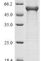 Pig Angiopoietin-2 (ANGPT2) Recombinant Protein - BioCrest Sci