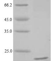 Heteroscodra maculata Delta-theraphotoxin-Hm1a Recombinant Protein, N-His-SUMO/C-Myc - BioCrest Sci